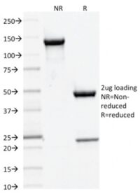 Data from SDS-PAGE analysis of Anti-DNMT3A antibody (Clone PCRP-DNMT3A-1E2). Reducing lane (R) shows heavy and light chain fragments. NR lane shows intact antibody with expected MW of approximately 150 kDa. The data are consistent with a high purity, intact mAb.